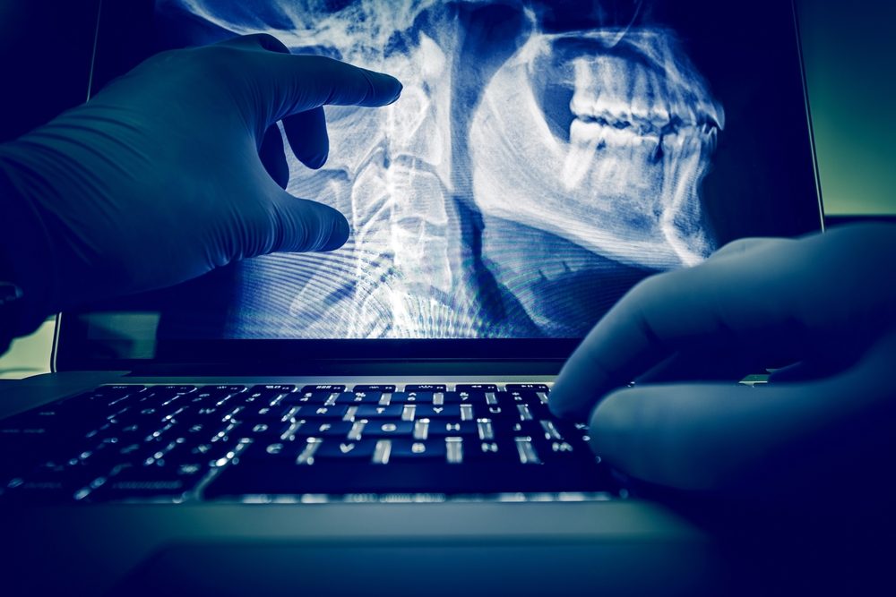 Why Digital X-Rays Are Better Than Traditional X-Rays | Corpus Christi ER