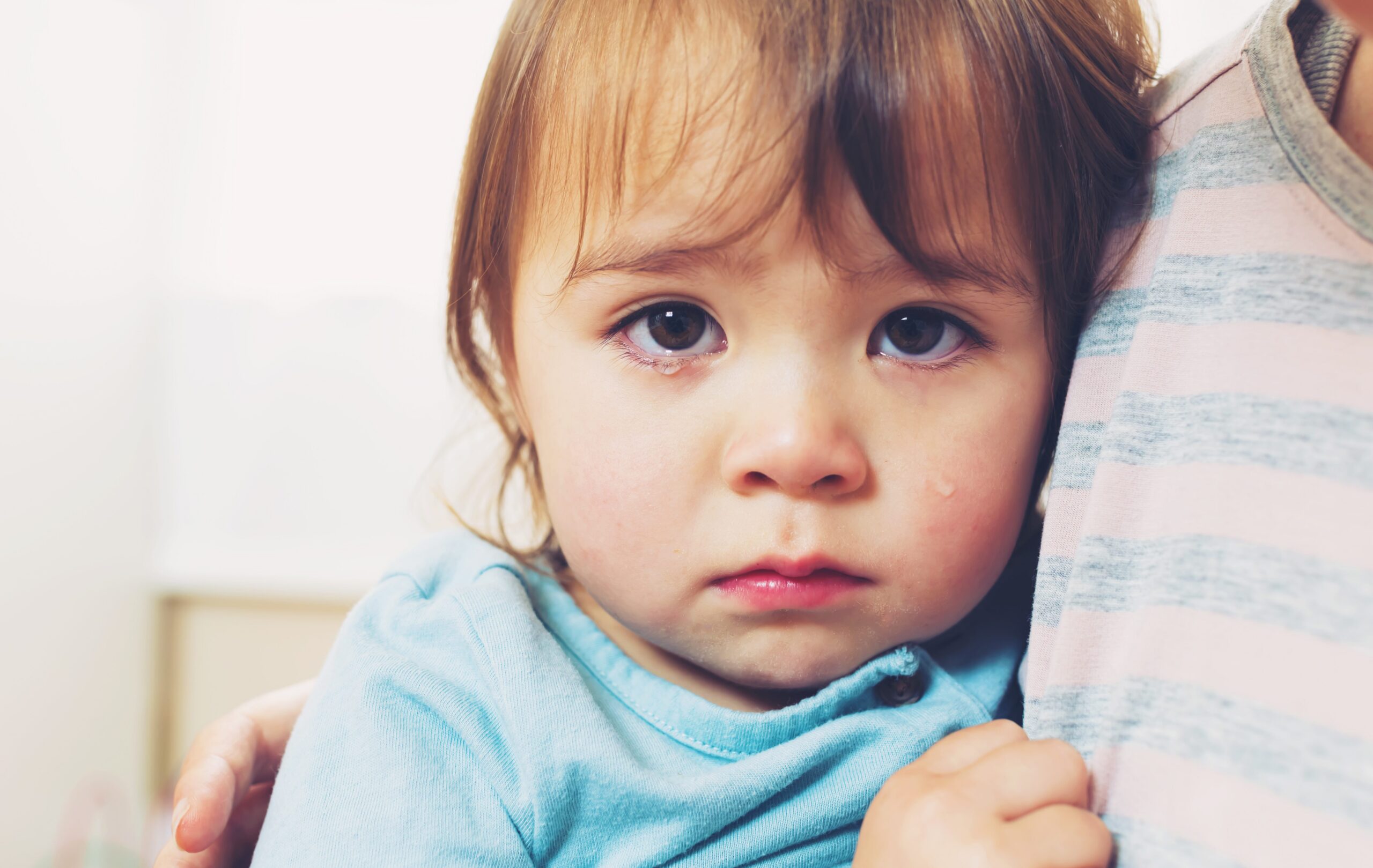 Skin Rashes in Children | Corpus Christi ER | Physicians Premier
