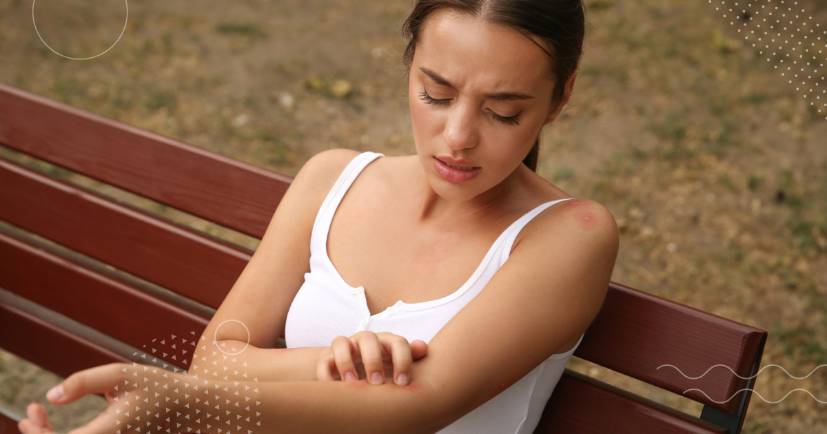 When to Seek Emergency Care for a Bug Bite